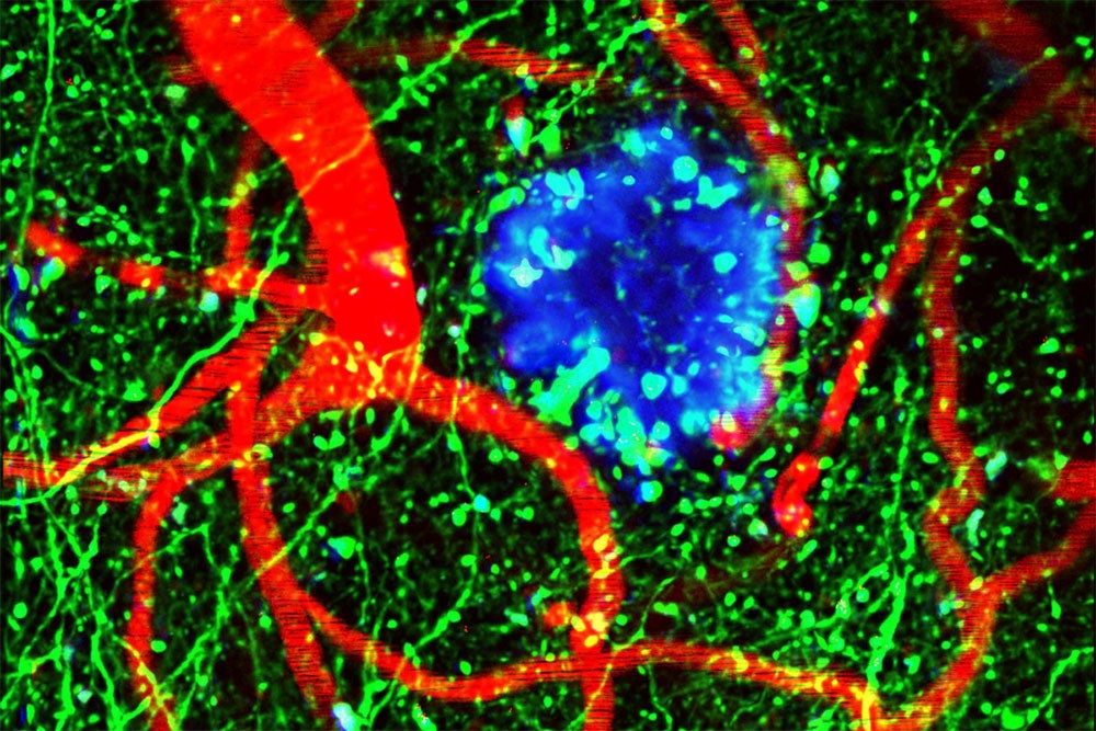 Neuropathobiology Research | Research | Virginia Tech