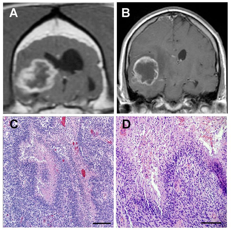 Comparative phenotypic features of canine (A, C) and human (B, D) glioblastoma as demonstrated with magnetic resonance imaging and histopathology. Post-contrast, T1-weighted magnetic resonance images of glioblastoma in the brains of a dog (A) and human (B). Photomicrographs of canine (C) and human (D) glioblastoma biopsies.