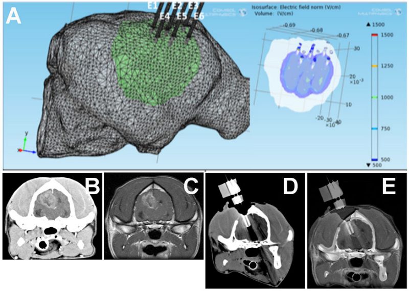 Stereotactic ablation of a canine glioblastoma (GBM) with irreversible electroporation (IRE). A- Preoperative treatment plan demonstrating optimal electrode placement and the resulting electrical field distribution in the tumor. Preoperative CT (B) and MRI (C) scans illustrating GBM in the parietal lobe of the brain. D- Intraoperative CT scan with IRE electrodes placed into the tumor. E- Intraoperative CT coregistered to MRI scan to confirm desired electrode placement.