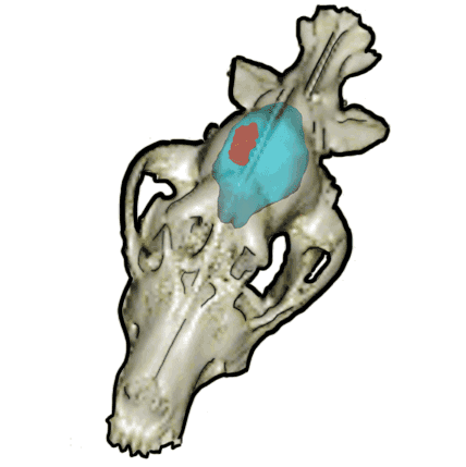 Schematic of the CED procedure used in the clinical trial. The dog is anesthetized and a catheter guide pedestal is surgically implanted into the skull. This facilitates accurate and secure placement of the catheter in a direct trajectory to the brain tumor for the infusion. The experimental drug cocktail is slowly infused into the tumor and monitored with MRI. Following completion of the infusion, the catheter is removed and the dog is recovered from anesthesia.