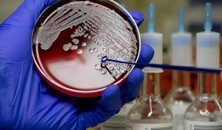 Neisseria gonorrhoeae Lab equipment photo in detail
